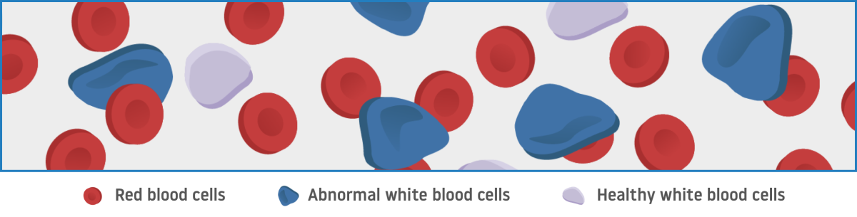 Blood cells in CML.